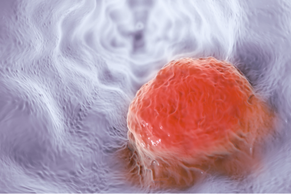 AI Breakthrough: Simple Blood Test Predicts Cancer Immunotherapy Success 🎉 AI_Breakthrough__Simple_Blood_Test_Predicts_Cancer_Immunotherapy_Success__
