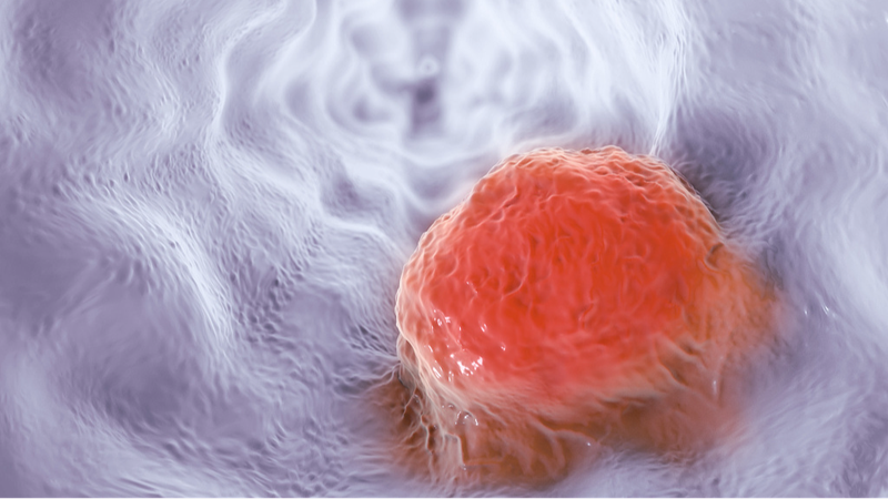 AI_Breakthrough__Simple_Blood_Test_Predicts_Cancer_Immunotherapy_Success__ - News for amigos, by amigos AI_Breakthrough__Simple_Blood_Test_Predicts_Cancer_Immunotherapy_Success__