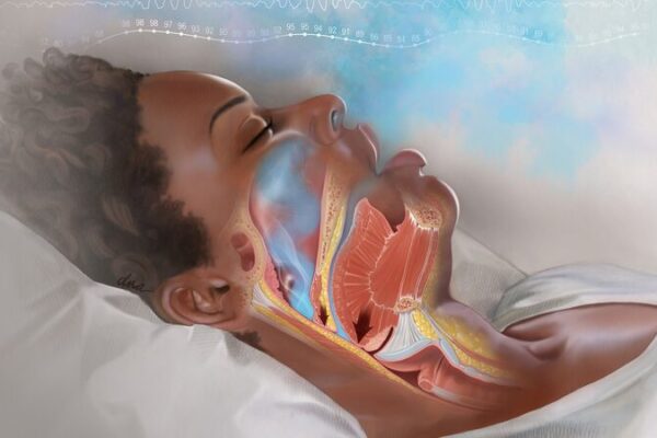 Australian Study Finds Snoring Linked to High Blood Pressure 😴❤️ Australian_Study_Finds_Snoring_Linked_to_High_Blood_Pressure____