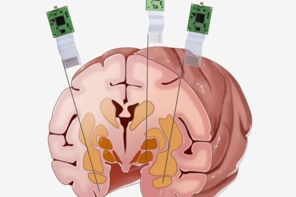 Chinese Scientists Make Breakthrough with Monkey Brain Neural Probe 🧠🐵 Chinese_Scientists_Make_Breakthrough_with_Monkey_Brain_Neural_Probe___