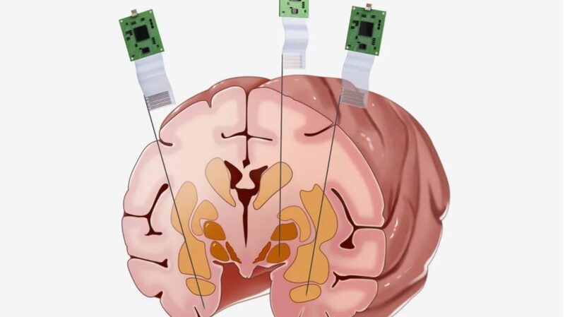 Chinese_Scientists_Make_Breakthrough_with_Monkey_Brain_Neural_Probe___ - News for amigos, by amigos Chinese_Scientists_Make_Breakthrough_with_Monkey_Brain_Neural_Probe___