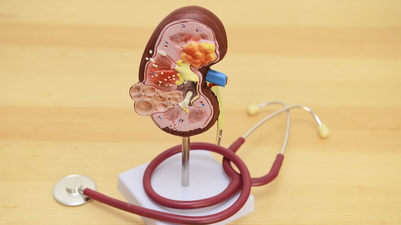 Croatia_s_Medical_Marvel__Kidney_Autotransplantation_Success_in_Rijeka__