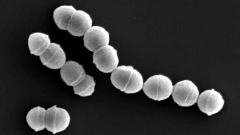 Japan_Faces_Surge_in__Flesh_Eating_Bacteria__Cases__Over_1_100_Infected - News for amigos, by amigos Japan_Faces_Surge_in__Flesh_Eating_Bacteria__Cases__Over_1_100_Infected