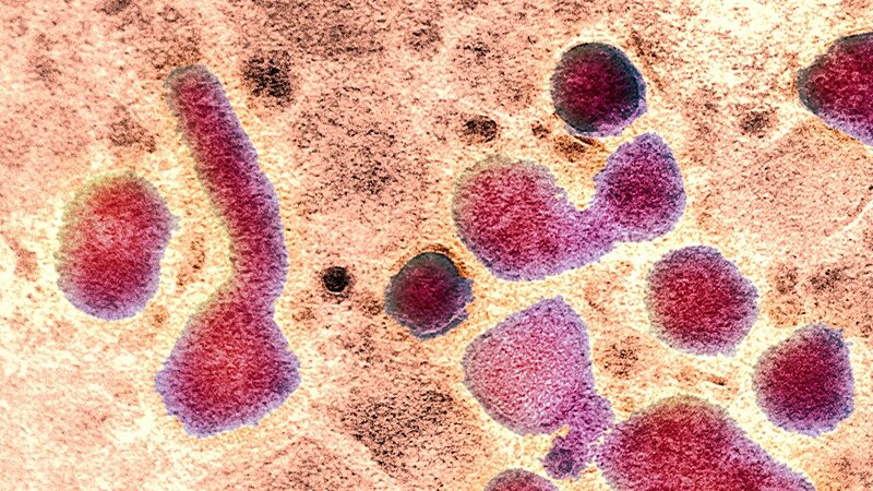 One_Tiny_H5N1_Mutation_May_Increase_Human_Infection_Risk__ - News for amigos, by amigos One_Tiny_H5N1_Mutation_May_Increase_Human_Infection_Risk__