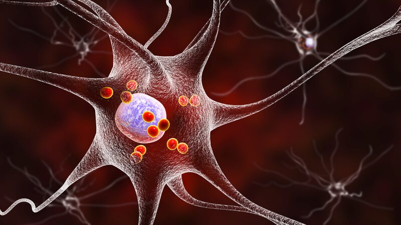 Chinese_Researchers_Unveil_Breakthrough_in_Parkinson_s_Treatment