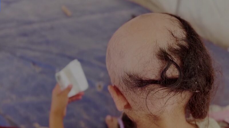 Gaza’s Children Face Trauma Amid Conflict Gaza_s_Children_Face_Trauma_Amid_Conflict
