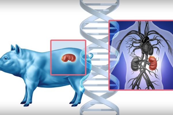 Gene-Edited Pig Kidney Transplant Brings New Hope Gene_Edited_Pig_Kidney_Transplant_Brings_New_Hope
