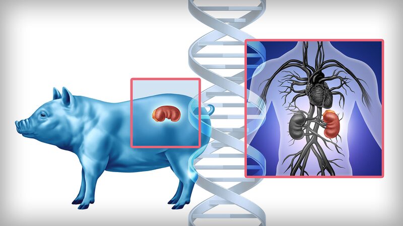 Gene_Edited_Pig_Kidney_Transplant_Brings_New_Hope