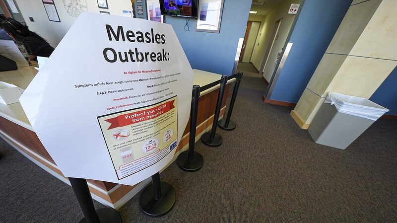 U_S__Measles_Surge__Texas_Reports_Most_Cases