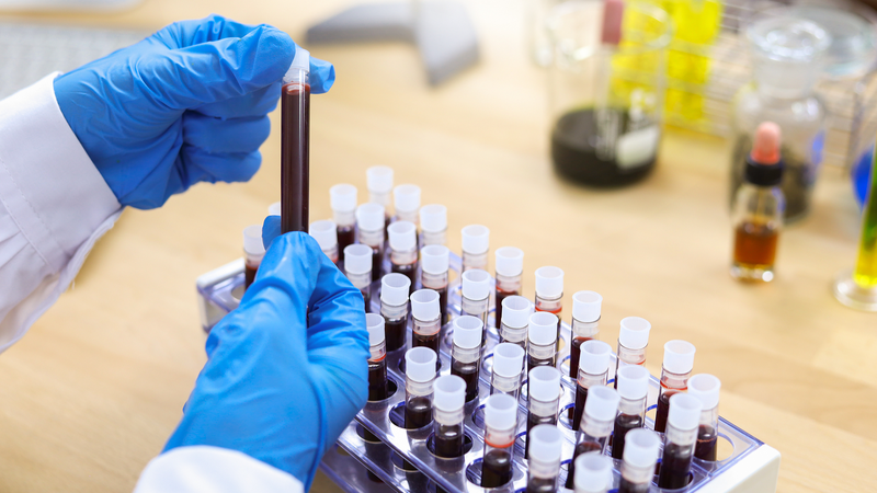 Breakthrough_Gene_Therapy_for_Hemophilia_B_in_China