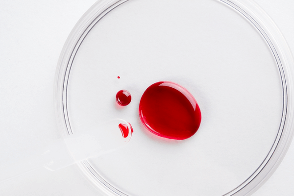 Study Finds “Forever Chemicals” in 85%+ of Australians’ Blood Study_Finds__Forever_Chemicals__in_85___of_Australians__Blood