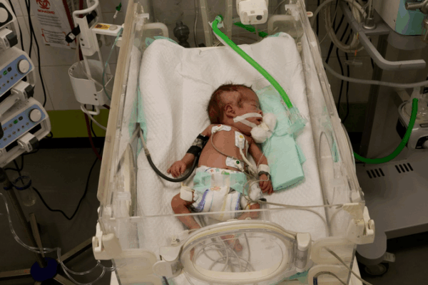 UN Warns: 14K Babies at Risk in Gaza Amid Escalating Aid Crisis UN_Warns__14K_Babies_at_Risk_in_Gaza_Amid_Escalating_Aid_Crisis