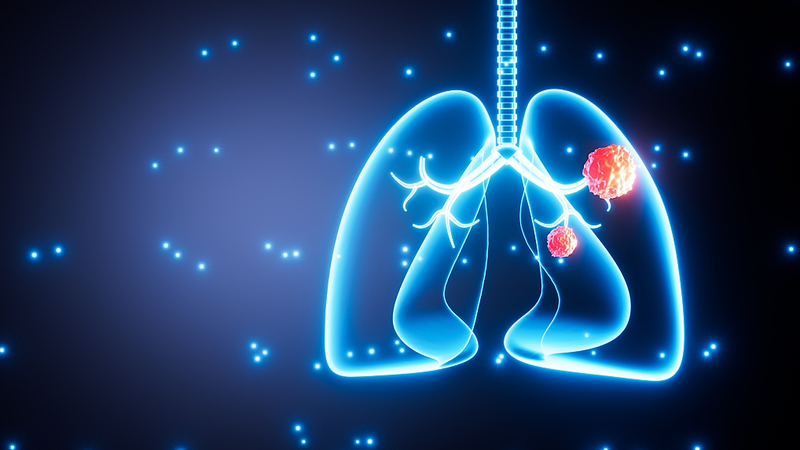 Air_Pollution_Sparks_Lung_Cancer_Mutations_in_Nonsmokers