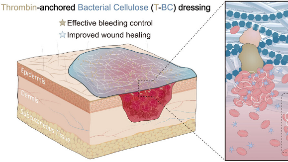 Breakthrough Bioactive Dressing Stops Burn Bleeding in Seconds! Breakthrough_Bioactive_Dressing_Stops_Burn_Bleeding_in_Seconds_
