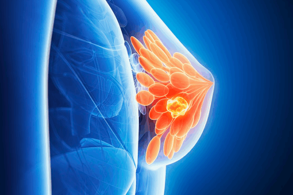 Australian Study: Breastfeeding Boosts Immunity Against Breast Cancer Australian_Study__Breastfeeding_Boosts_Immunity_Against_Breast_Cancer