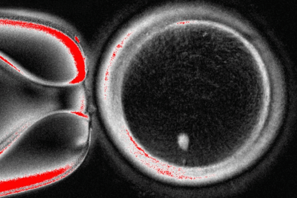 Scientists Turn Skin Cells into Human Eggs in Lab Breakthrough Scientists_Turn_Skin_Cells_into_Human_Eggs_in_Lab_Breakthrough