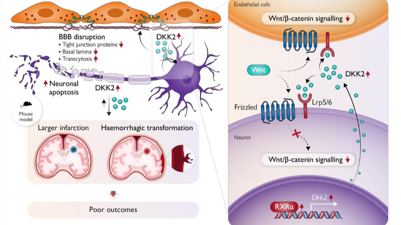 Chinese_Researchers_Pinpoint_Molecule_Behind_Post_Stroke_Brain_Damage