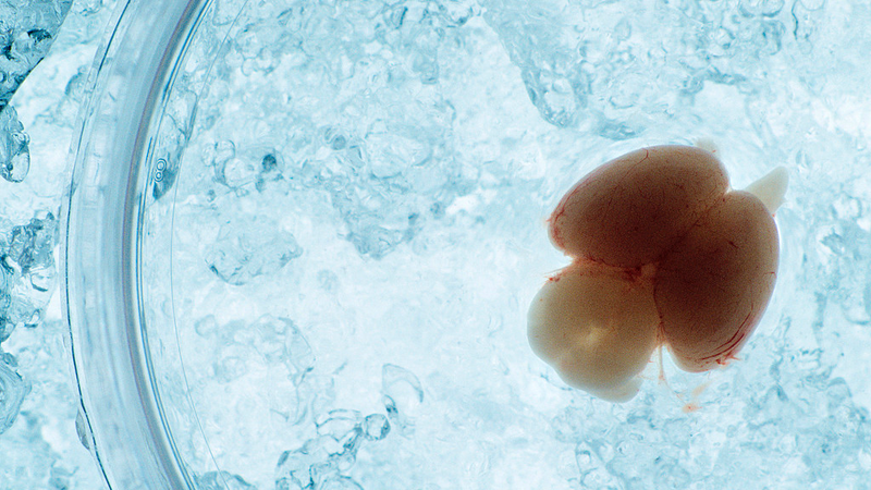 Chinese_Team_Unveils_Live_Imaging_of_Embryonic_Mouse_Brain